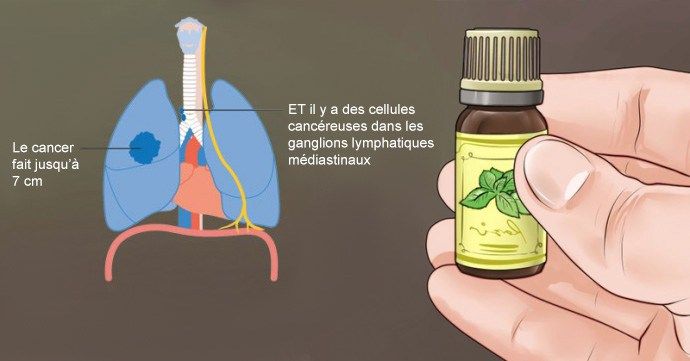 cancer-huiles-essentielles-compressor